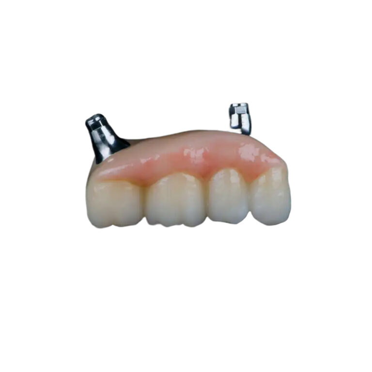 4 tænder på 2 implantater