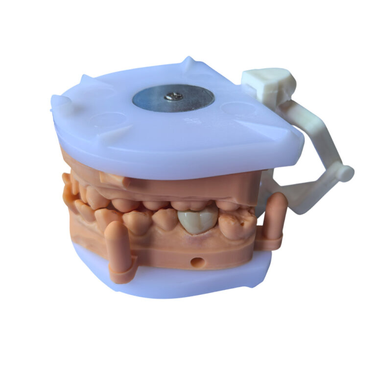 Corona de circonio A2