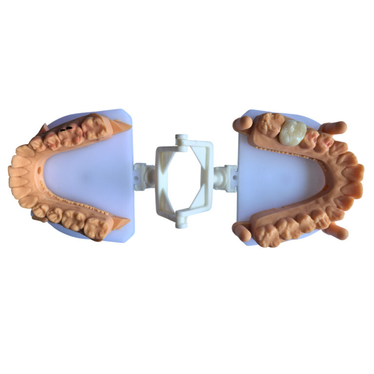 Corona de circonio A2