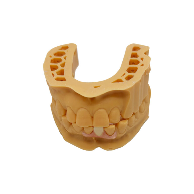 Añadir dientes a la prótesis parcial Valplast