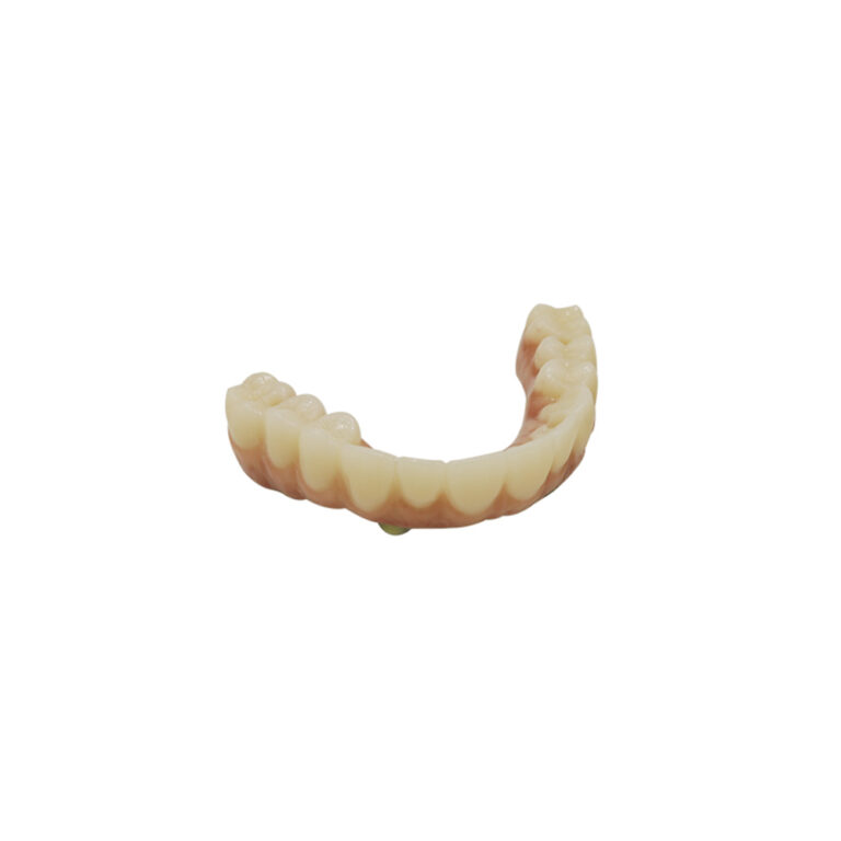 Implanty stomatologiczne All On 2