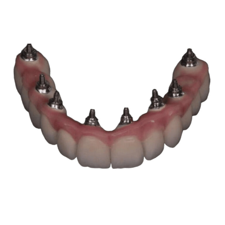 All On 8 Dental Implants