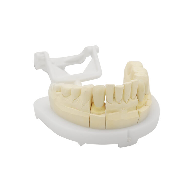 Anterior Zirconia Crown