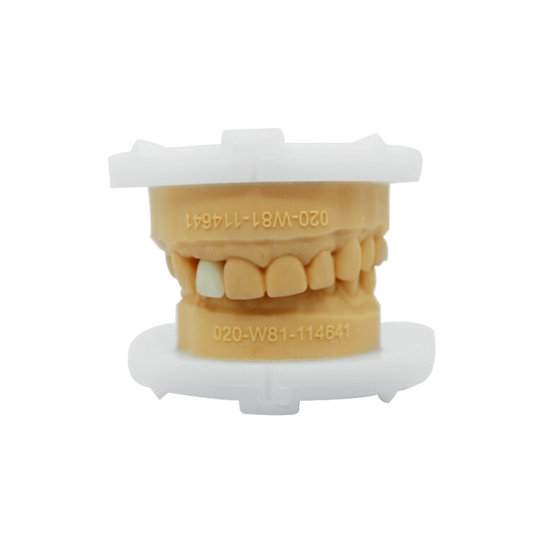 Anterior Zirconia Crown