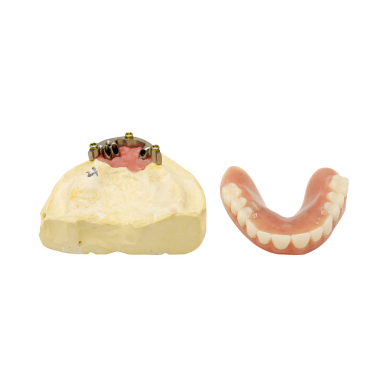 Best Cheap Dentures For Seniors