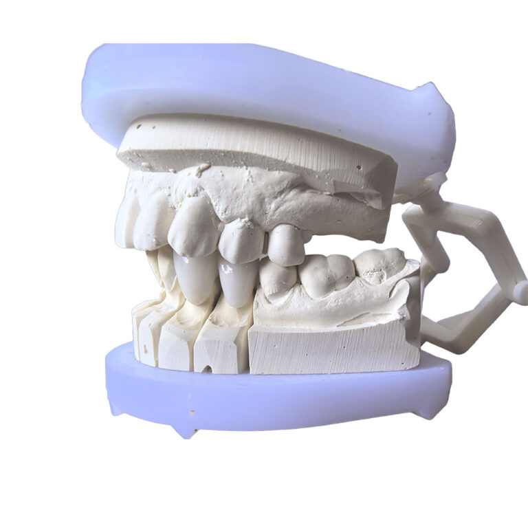 Couronnes en zircone Bl2