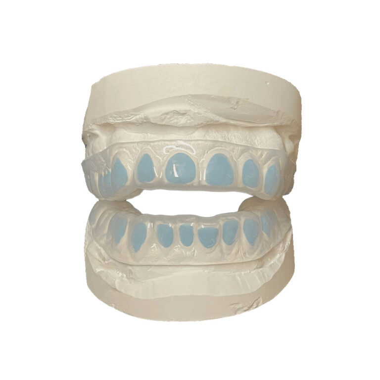 Персонализирани плочи за избелване на зъби