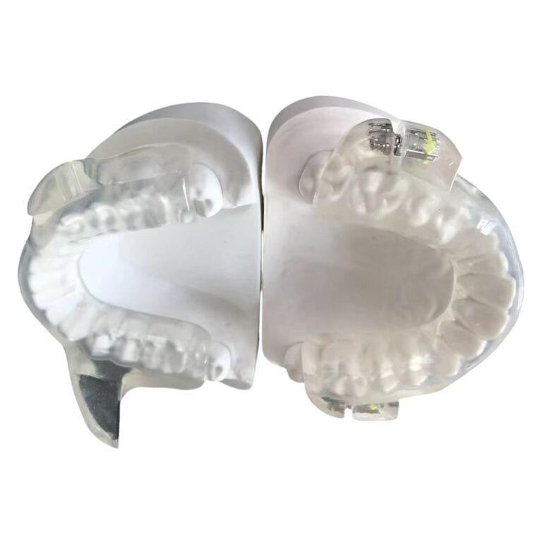 Individueller Schlafapnoe-Mundschutz