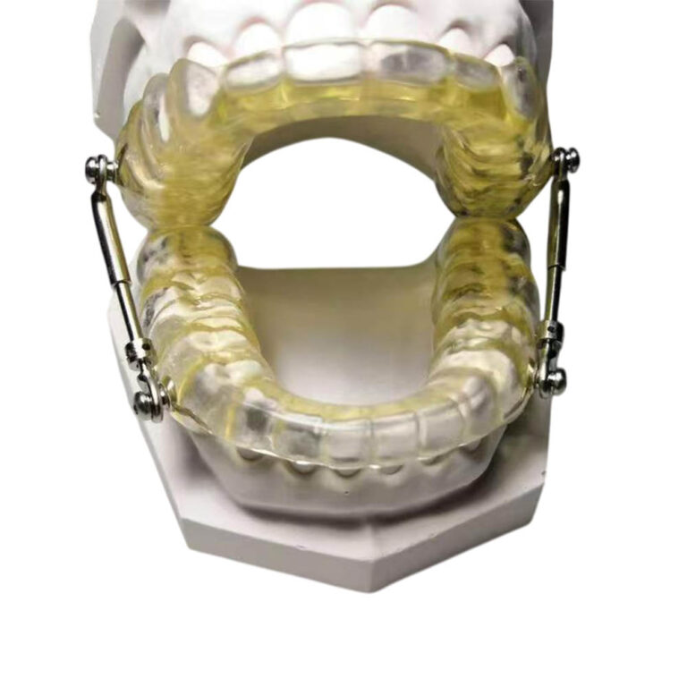 Individueller Schlafapnoe-Mundschutz