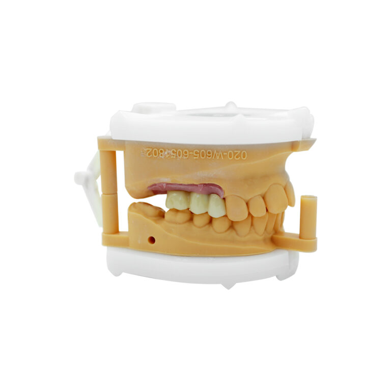 Dental Implant Prosthetics