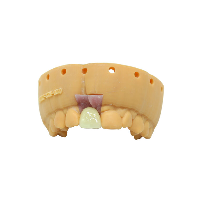 Dental Implant Prosthetics