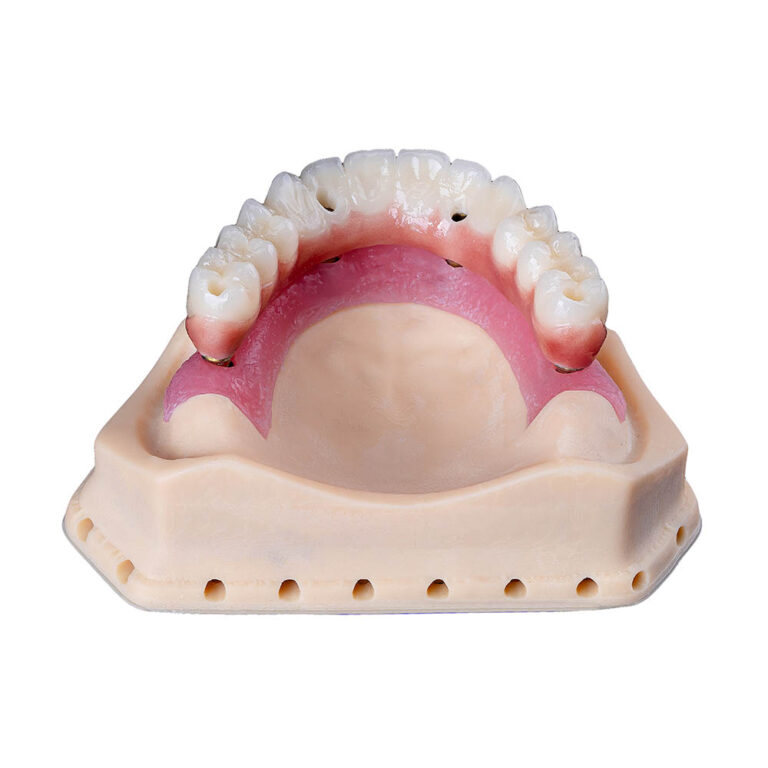 Dental Implants For Seniors