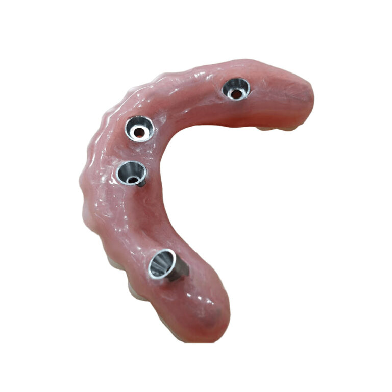 Dentures That Screw In