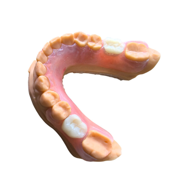 Flexible Denture Two Teeth