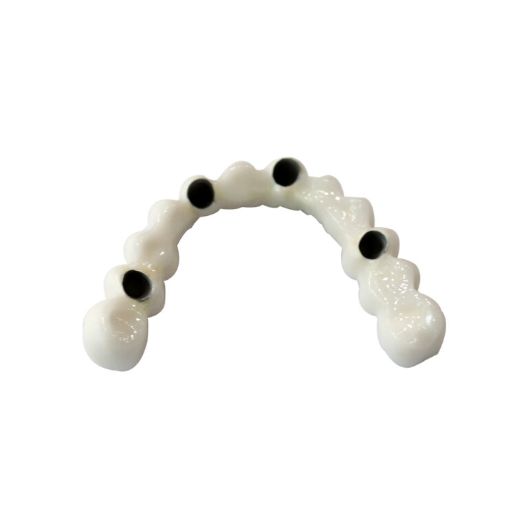 Full Arch Dental Implants