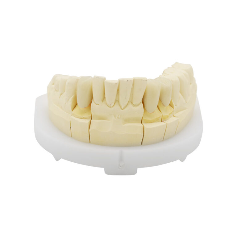 Zirkonia-krone med fuld kontur