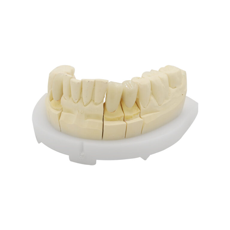 Full Contour Zirconia-krone og -bro