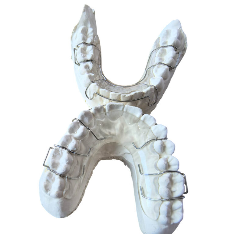 Hawley Orthodontic Retainer