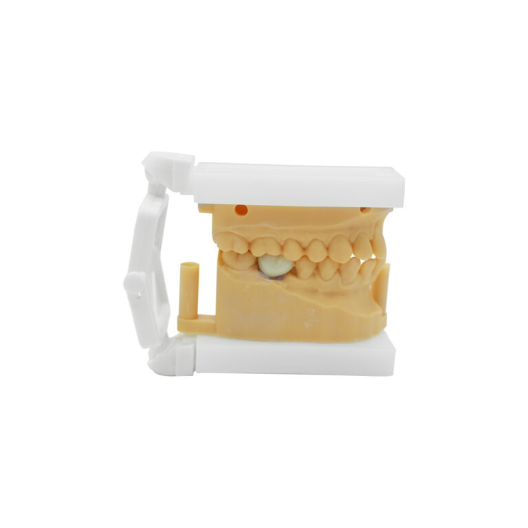 Lower Dental Implants