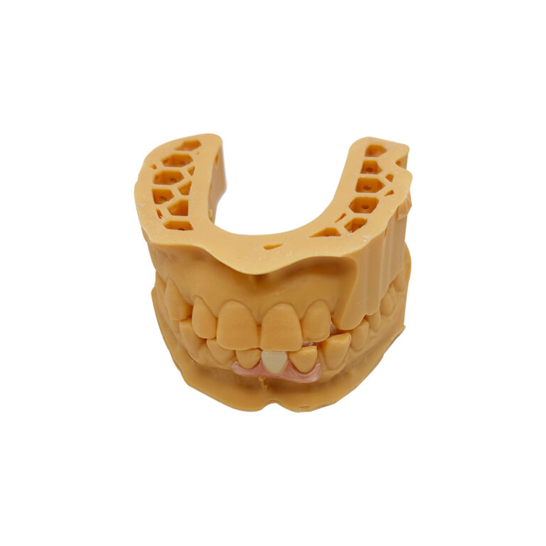Lower Flexible Partial Dentures For Front tooth