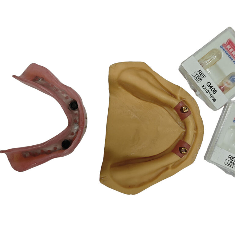 Magnetiske tandproteser