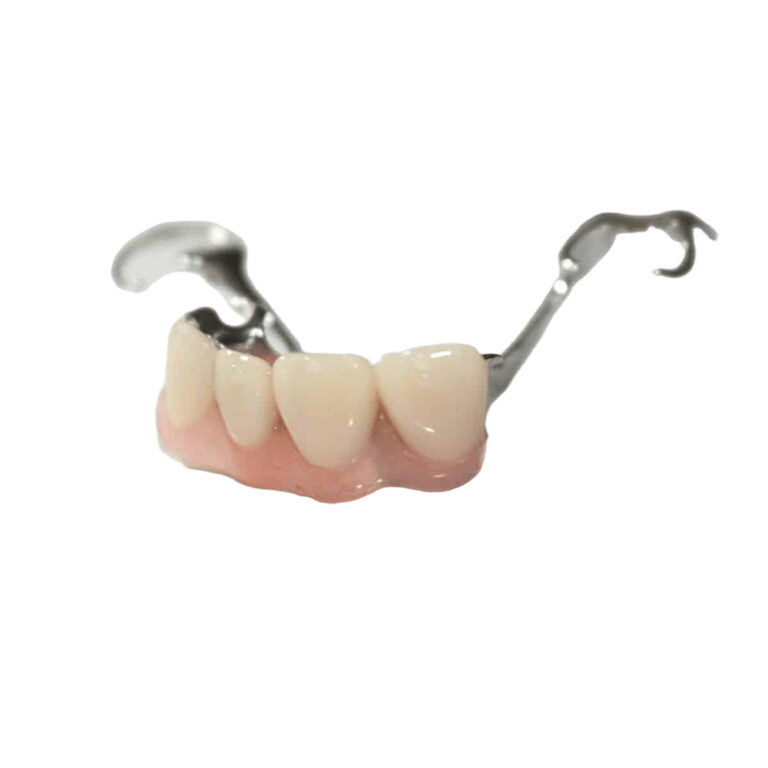 Metal Dentures For Front Teeth