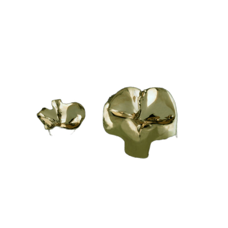 Tandindlæg af metal