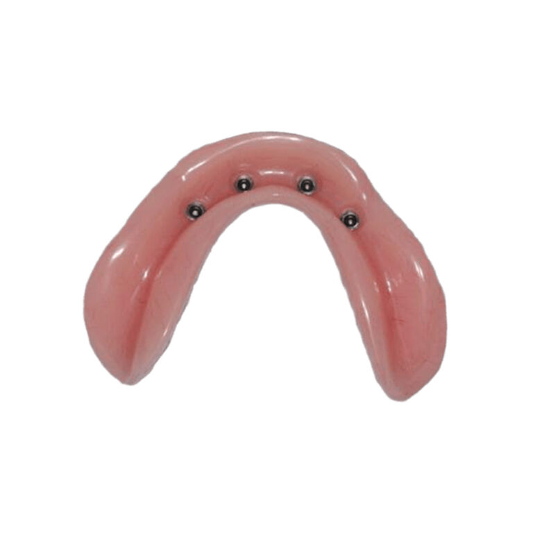 Мини импланти за зъбни протези