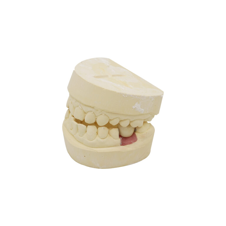 Зъбни импланти Nobel Biocare