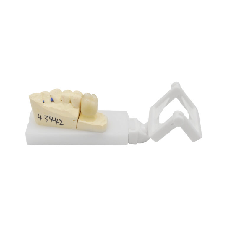 PFM Crown Molar