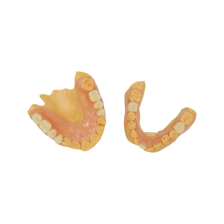 Partial Denture without Metal Clasps