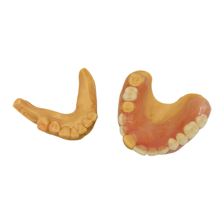 Partial Denture without Metal Clasps
