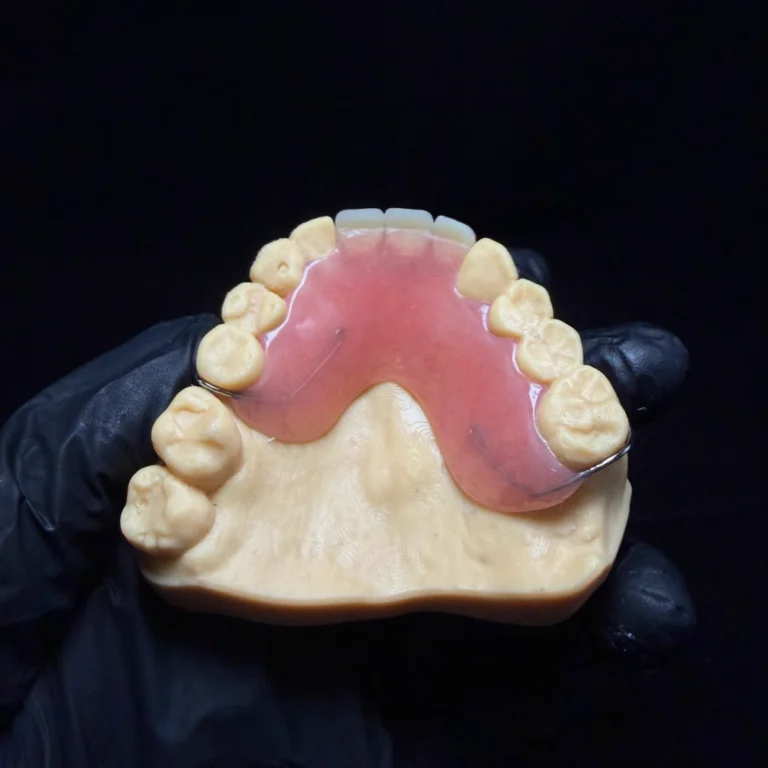 Partial Dentures for Front Teeth (3)
