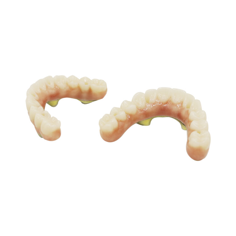 Screw Retained Implant Crown