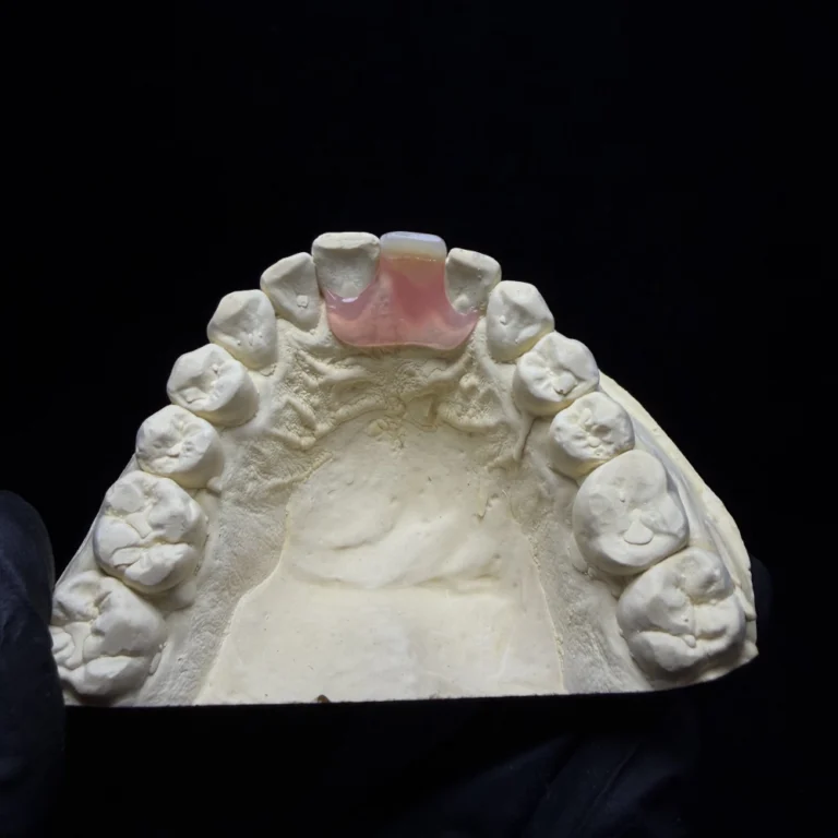 Single Tooth Denture Case (1)