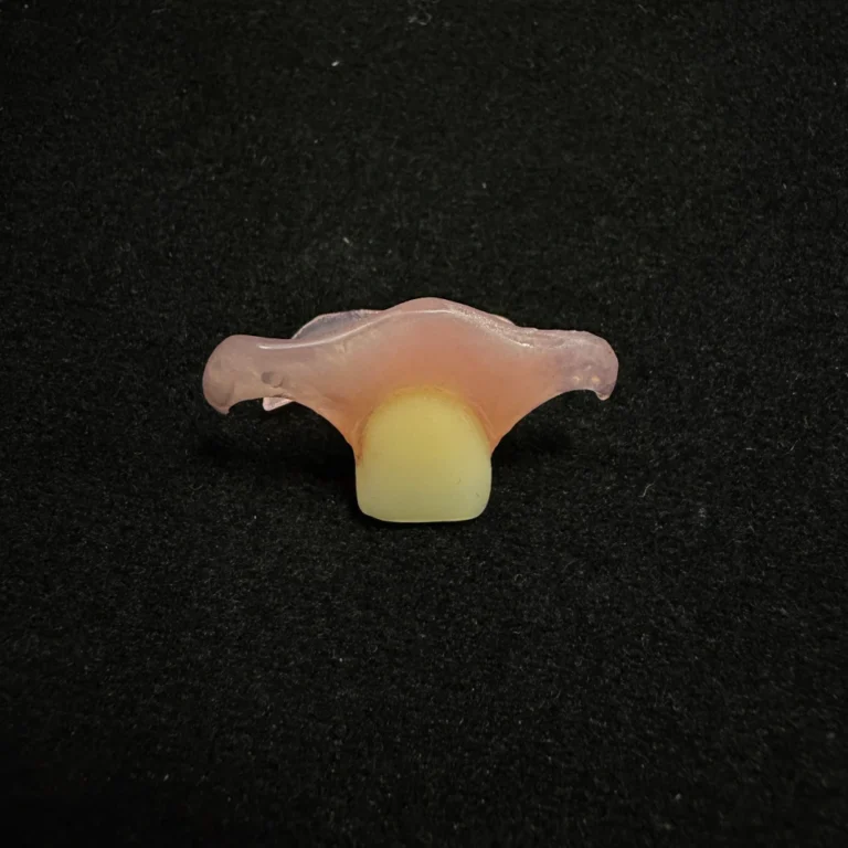 Single Tooth Denture Case (3)