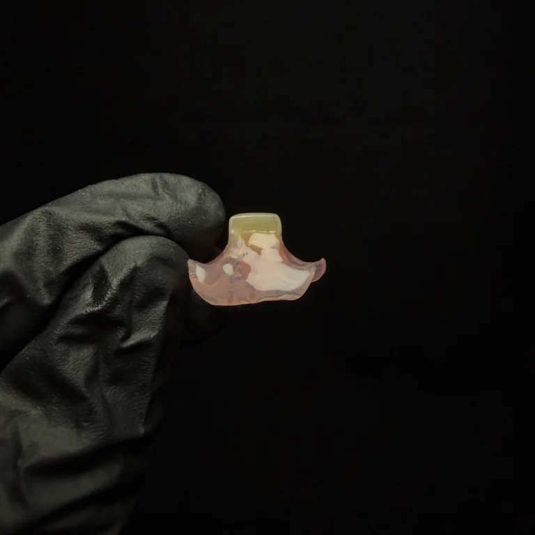 Single Tooth Denture Case (4)