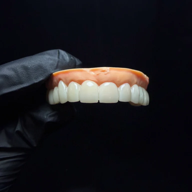 Temporary Bridge Dental (1)