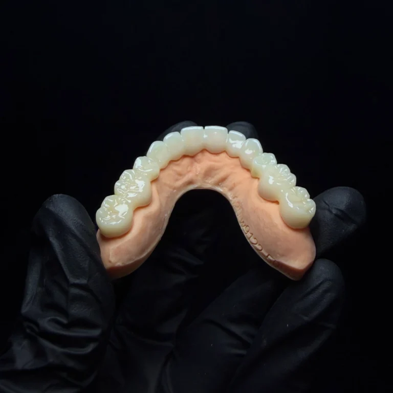 Temporary Bridge Dental (2)