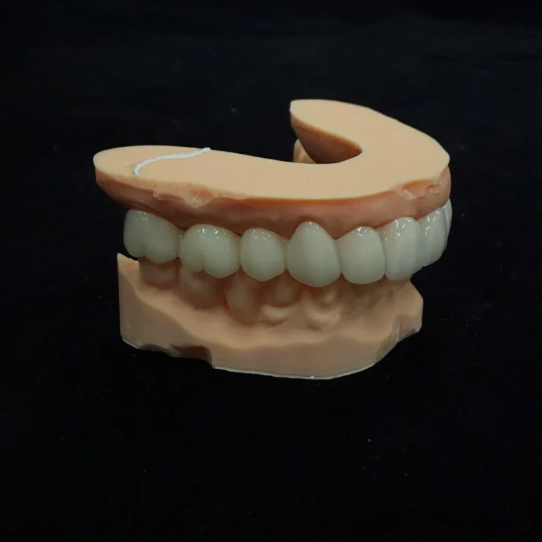 Temporary Bridge Dental (3)