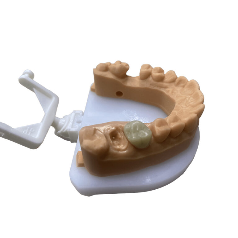 Dent molaire temporaire