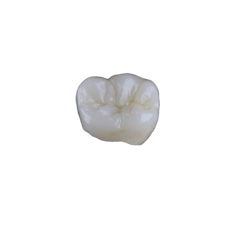 Translucent Zirconia Crowns
