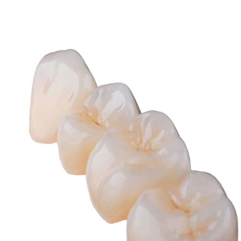 Translucent Zirconia Crowns