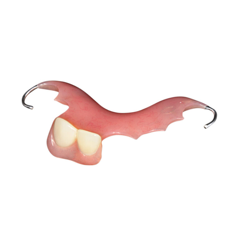 Частични протези за два предни зъба