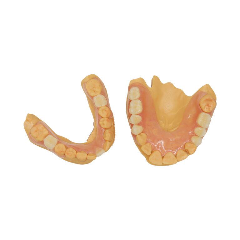 상부 및 하부 발플라스트 부분