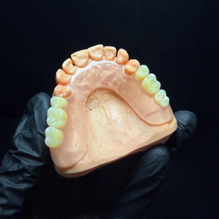 Valplast Denture Case (2)