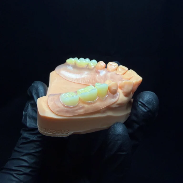 Valplast Denture Case (3)