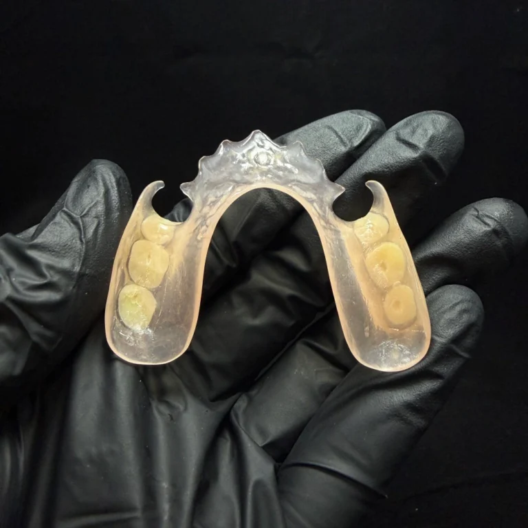 Valplast Denture Case (4)