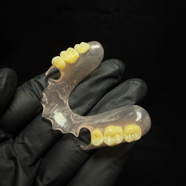 Valplast Denture Case (5)