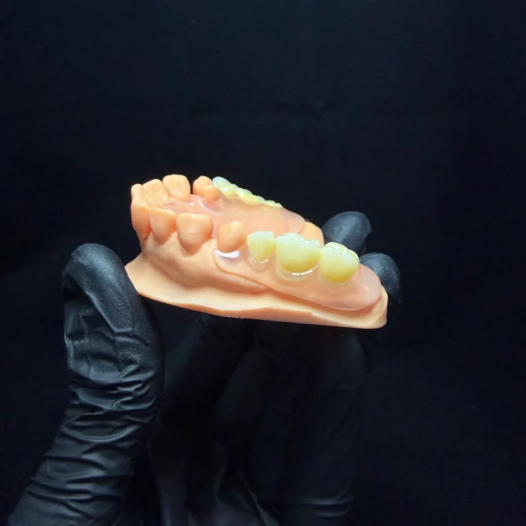 Valplast Denture Case